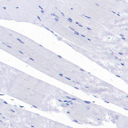 CBS Rabbit Polyclonal Antibody
