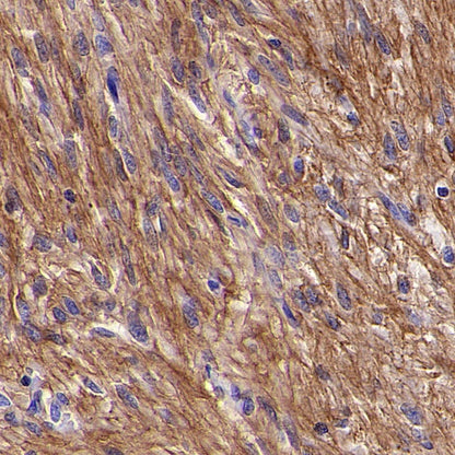 TMEM16A Recombinant Rabbit mAb (SDT-2179-68)