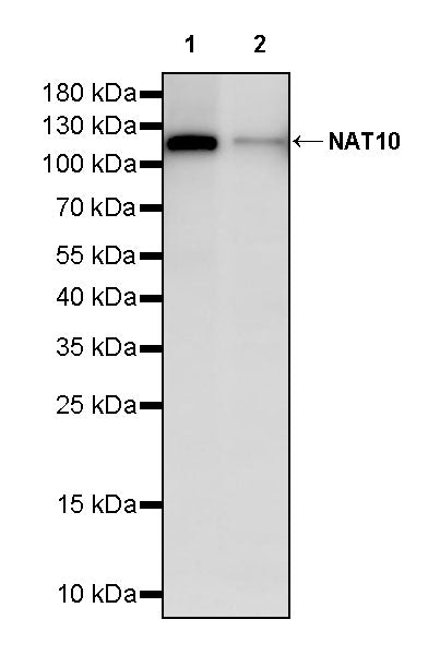 NAT10 Recombinant Rabbit mAb (S-2547-125)