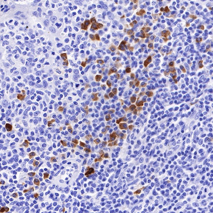Kappa light chain Recombinant Rabbit mAb (S-385-23)