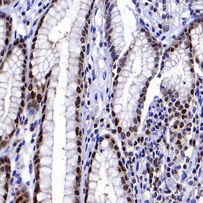 PDCD4 Rabbit polyclonal antibody