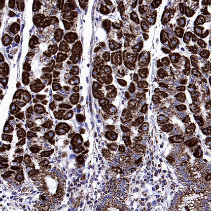 SDHA Recombinant Rabbit mAb (S-1458-43)
