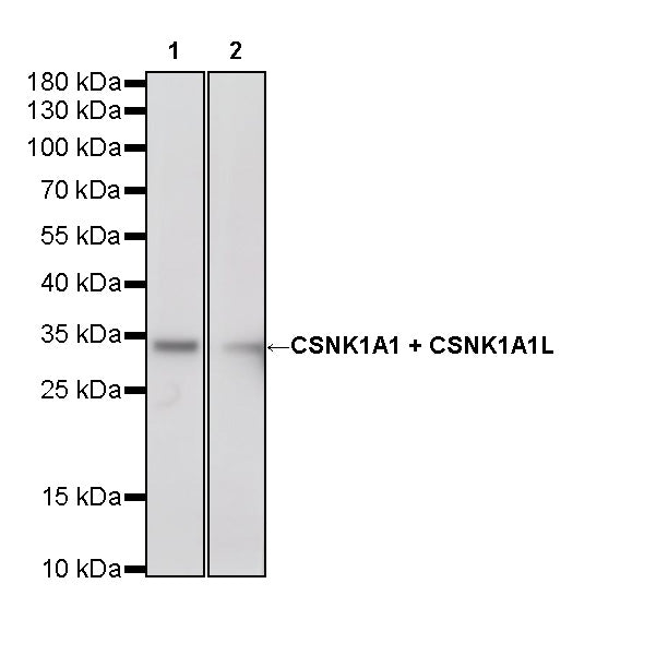 CSNK1A1 + CSNK1A1L Recombinant Rabbit mAb (S-4407-18)