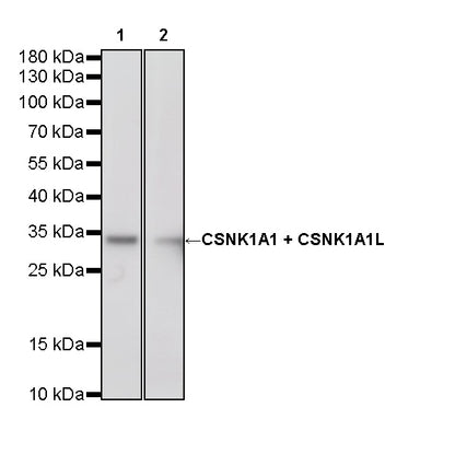 CSNK1A1 + CSNK1A1L Recombinant Rabbit mAb (S-4407-18)