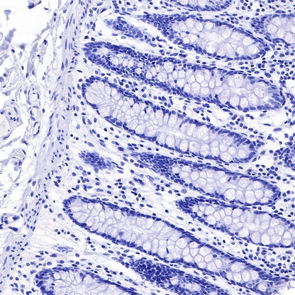 Placental lactogen Recombinant Rabbit mAb (S-454-142)