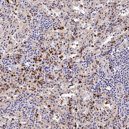 PBEF/Visfatin/NAMPT Rabbit Polyclonal Antibody