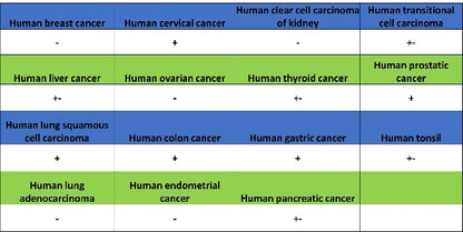 Jagged1 Recombinant Rabbit mAb (S-3296)