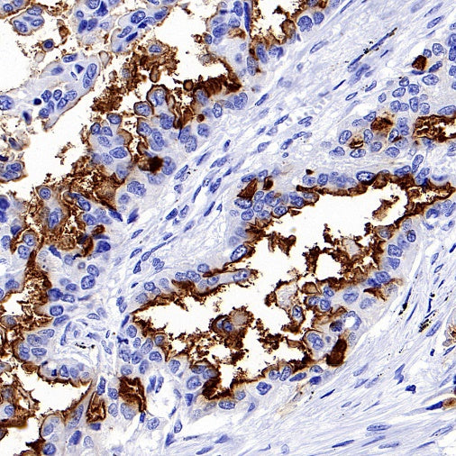 NaPi2b/SLC34A2 Recombinant Rabbit mAb (SDT-R229)