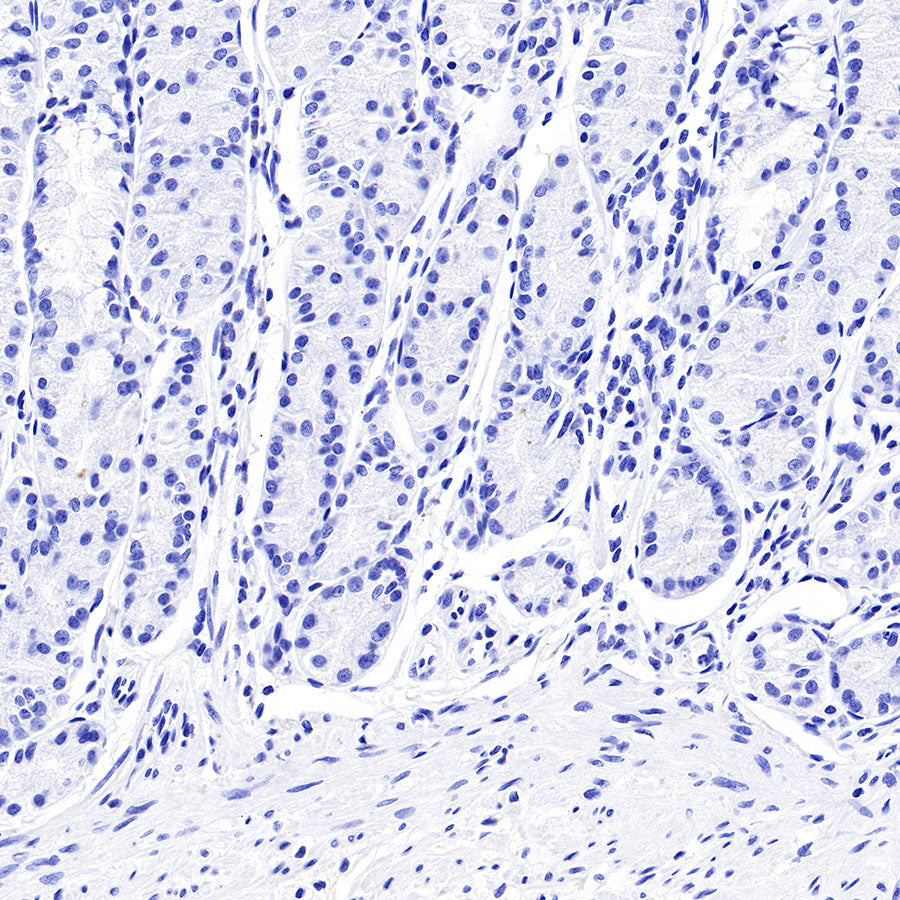 CGA/HCG-α Recombinant Rabbit mAb (SDT-227-66)