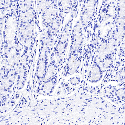 CGA/HCG-α Recombinant Rabbit mAb (SDT-227-66)