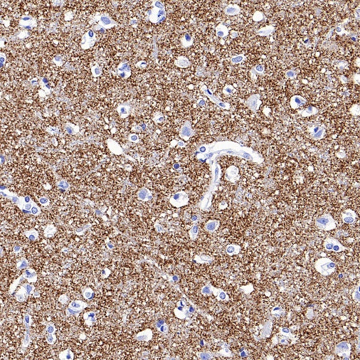 VGlut1 Recombinant Rabbit mAb (S-1587-19)