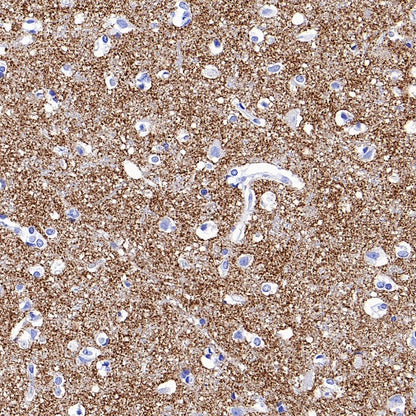 VGlut1 Recombinant Rabbit mAb (S-1587-19)