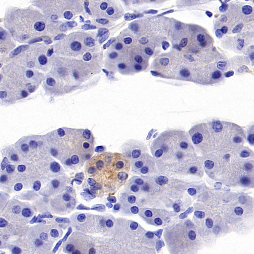Progranulin/PGRN Recombinant Rabbit mAb (S-1090-110)