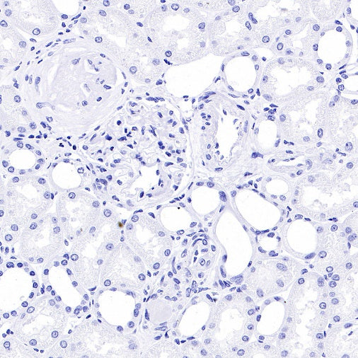 PTH Recombinant Rabbit mAb (S-539-28)