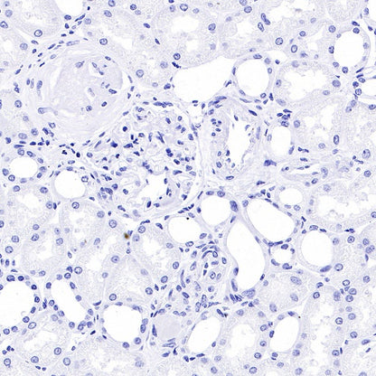 PTH Recombinant Rabbit mAb (S-539-28)