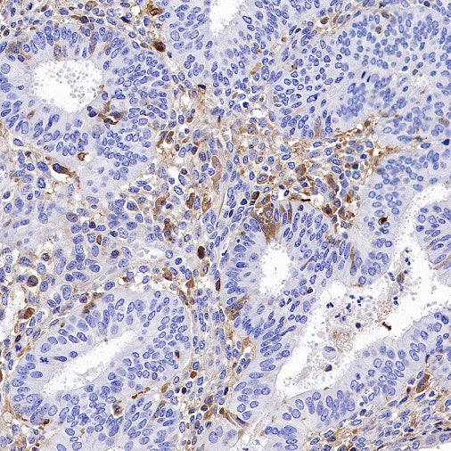 TIM-3 Recombinant Rabbit mAb (S-1450-21)