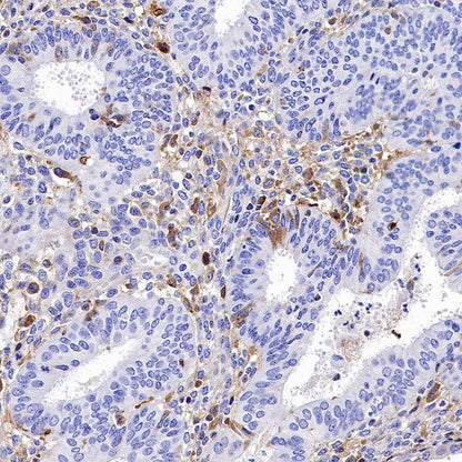 TIM-3 Recombinant Rabbit mAb (S-1450-21)