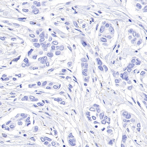 PGP9.5 Recombinant Rabbit mAb (SDT-665-37)