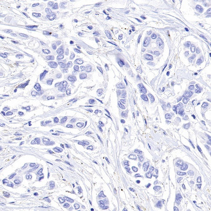 PGP9.5 Recombinant Rabbit mAb (SDT-665-37)