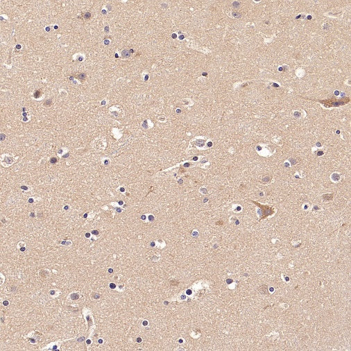 GDNF Receptor alpha 1/GFRA1 Recombinant Rabbit mAb (S-3289-52)