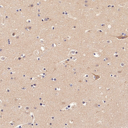 GDNF Receptor alpha 1/GFRA1 Recombinant Rabbit mAb (S-3289-52)
