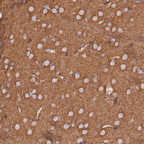α-tubulin (acetyl K40) Recombinant Rabbit mAb (S-1536-100)
