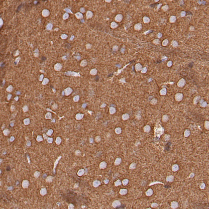 α-tubulin (acetyl K40) Recombinant Rabbit mAb (S-1536-100)