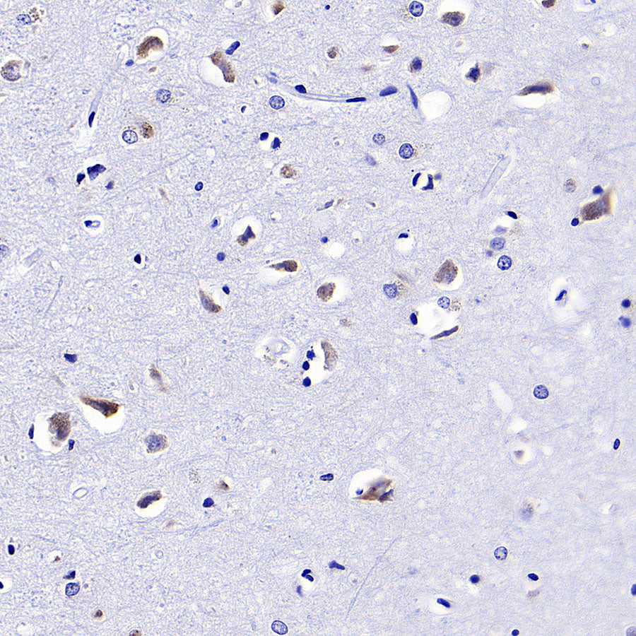 CCDC47 Recombinant Rabbit mAb (S-4158-17)