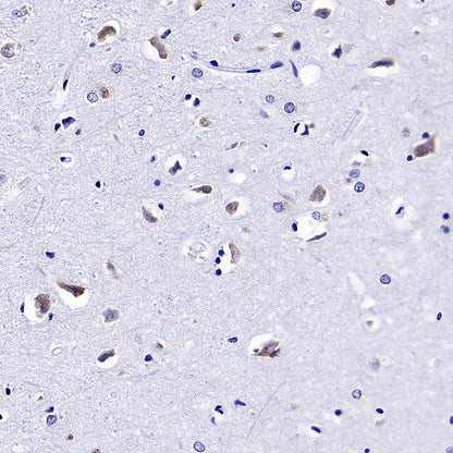CCDC47 Recombinant Rabbit mAb (S-4158-17)