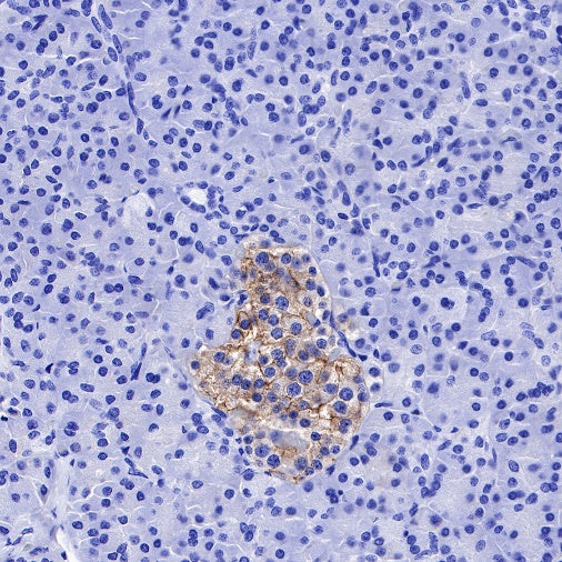 ENT1 Recombinant Rabbit mAb (SDT-R182)