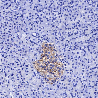 ENT1 Recombinant Rabbit mAb (SDT-R182)