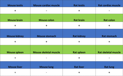 GFPT1 Recombinant Rabbit mAb (S-4752-19)