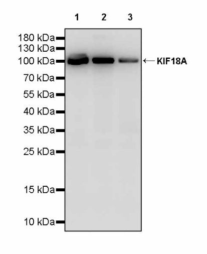 KIF18A Recombinant Rabbit mAb (S-3310-11)