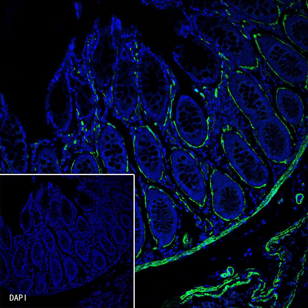 alpha smooth muscle Actin Recombinant Rabbit mAb (Alexa Fluor® 488 Conjugate) (SDT-132-63)