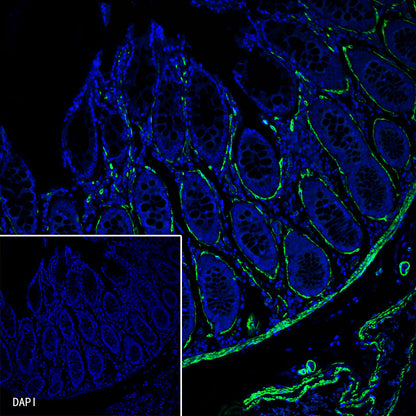 alpha smooth muscle Actin Recombinant Rabbit mAb (Alexa Fluor® 488 Conjugate) (SDT-132-63)