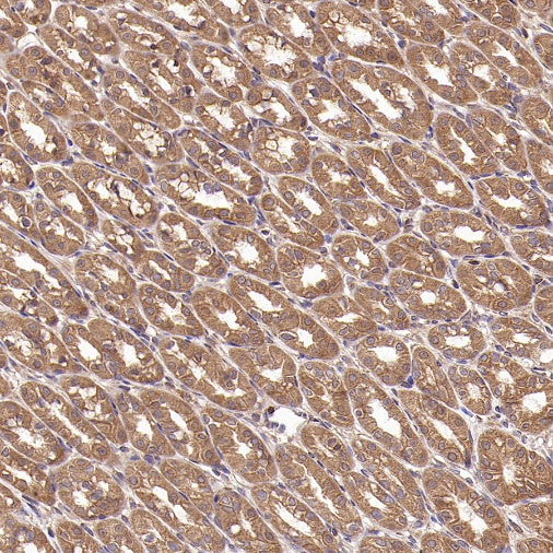 TRAF6 Recombinant Rabbit mAb (S-1087-44)