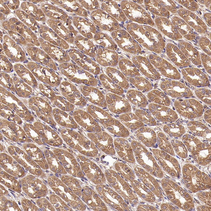 TRAF6 Recombinant Rabbit mAb (S-1087-44)