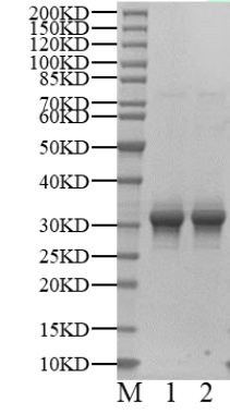 IKKβ GST Tag Protein, Human