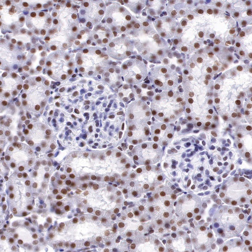 S-RMab®Topoisomerase I Recombinant Rabbit mAb (S-R209)