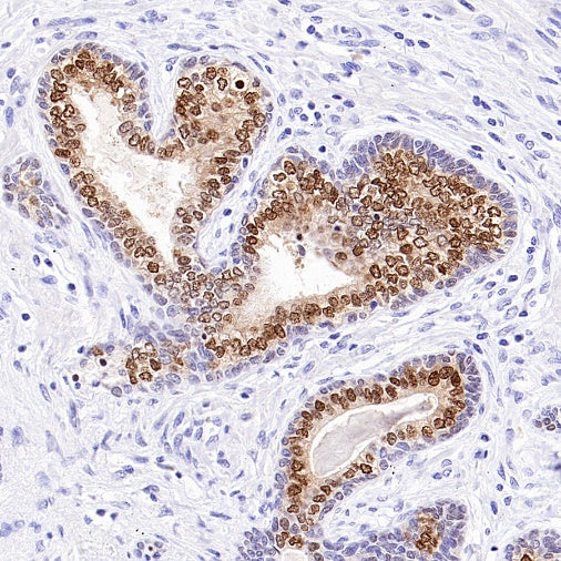NKX3.1 Recombinant Rabbit mAb (S-2778-63)