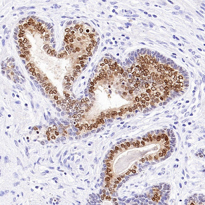 NKX3.1 Recombinant Rabbit mAb (S-2778-63)