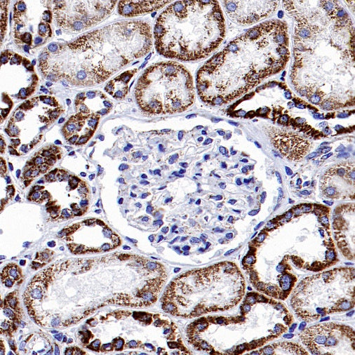 NDUFS8 Recombinant Rabbit mAb (S-1273-10)
