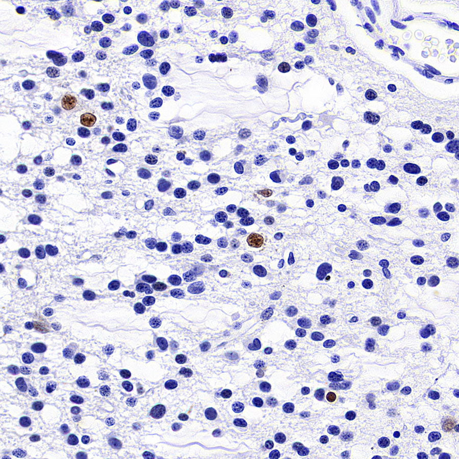 FOXG1 Recombinant Rabbit mAb (S-5244)