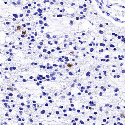 FOXG1 Recombinant Rabbit mAb (S-5244)