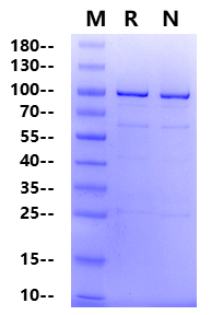PLK1 GST&His Tag Protein, Human