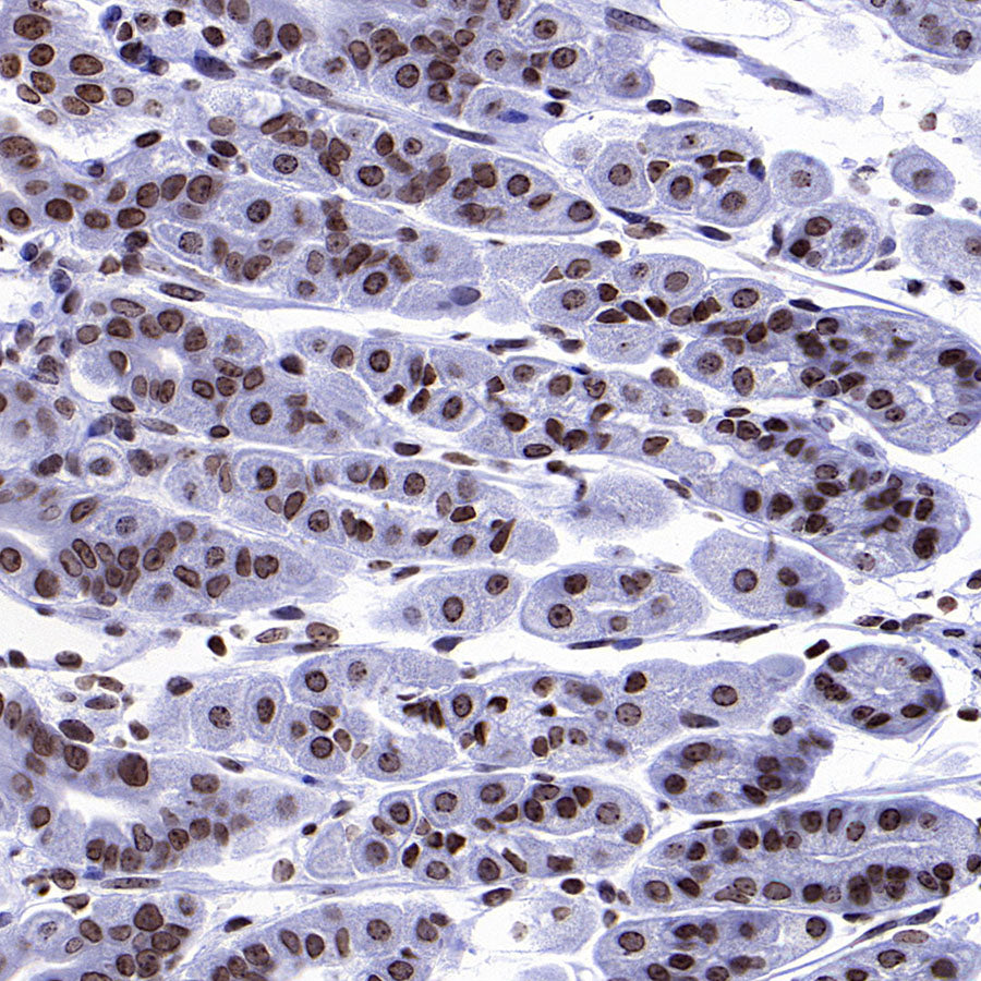 Histone H3 Recombinant Rabbit mAb (S-5672)