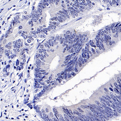MLH1 Recombinant Mouse mAb,PBS Only (SDT-R702)