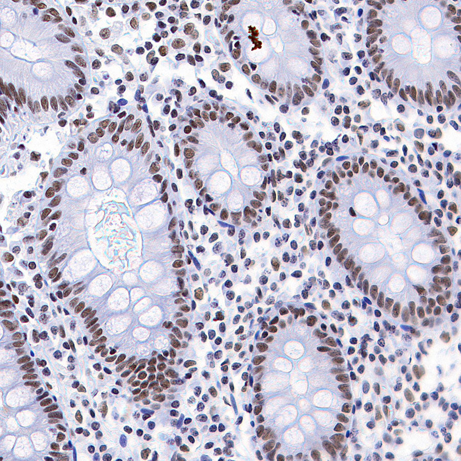 Rad21 Recombinant Rabbit mAb (S-M0006)