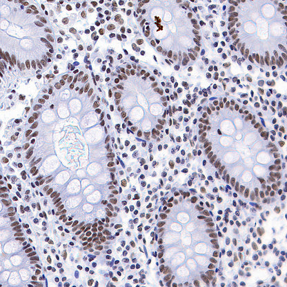 Rad21 Recombinant Rabbit mAb (S-M0006)