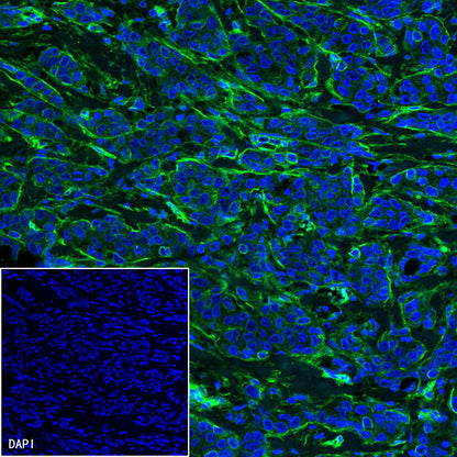 S-RMab®B7-H3/CD276 Recombinant Rabbit mAb (SDT-R158)